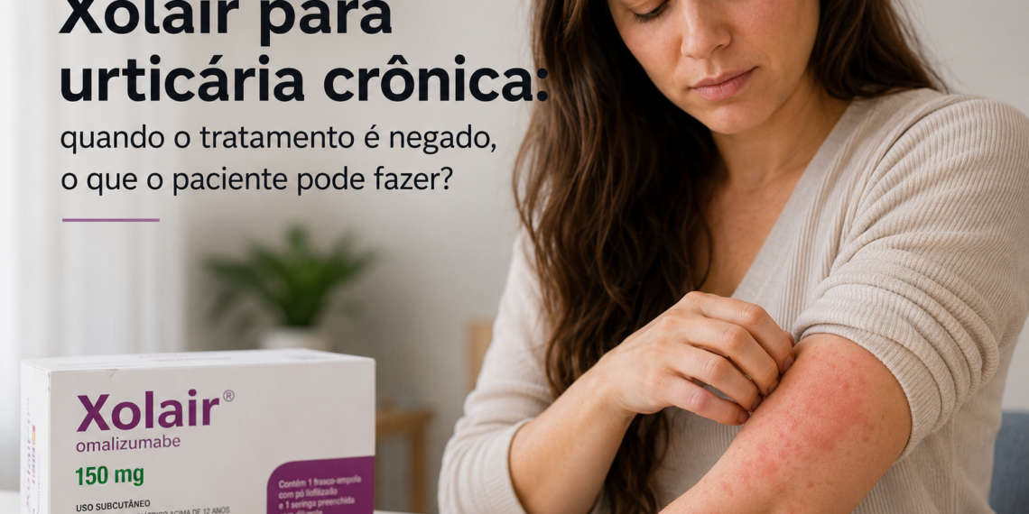 Xolair para urticária crônica: quando o tratamento é negado, o que o paciente pode fazer?
