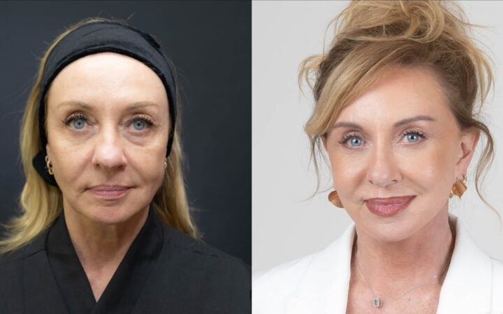 “Bem-vindos ao luxo”: facelift reforça imagem de corretora de alto padrão